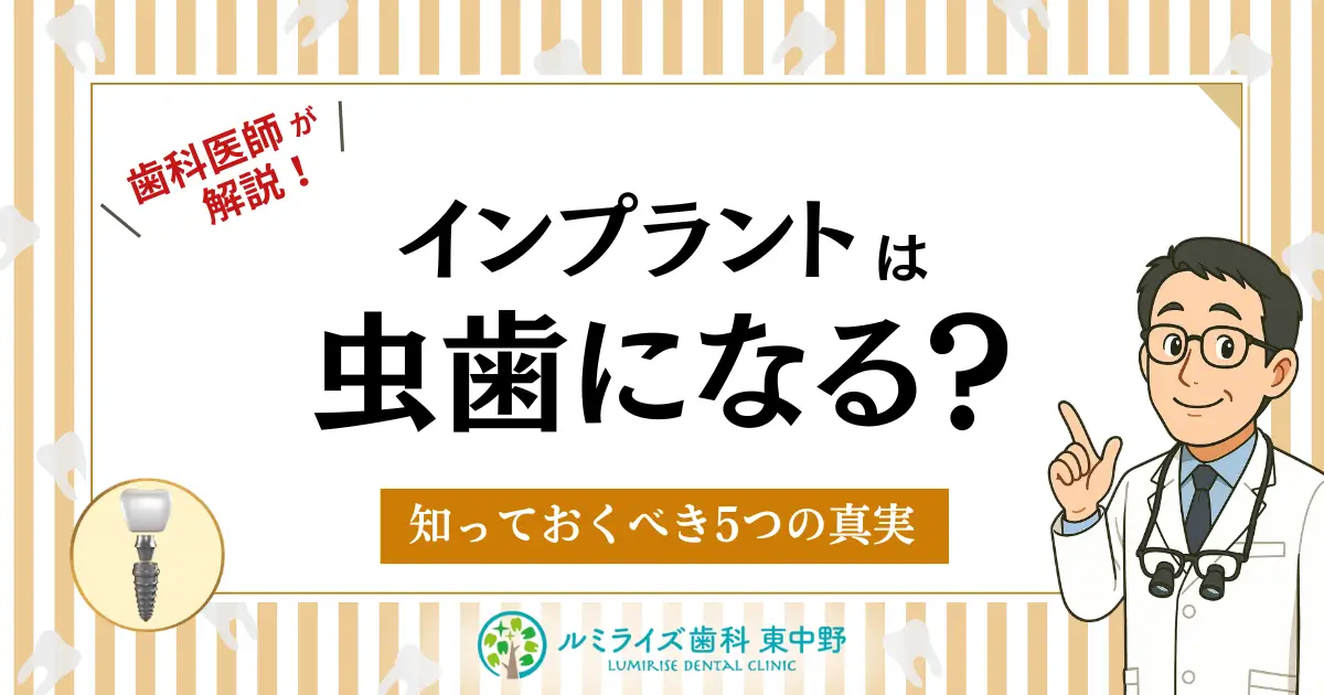 インプラントは虫歯になる?【歯科医が解説】知っておくべき5つの真実