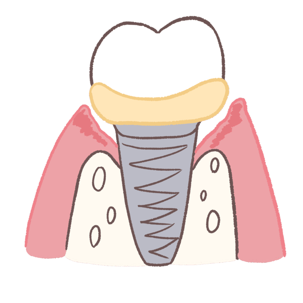 インプラント周囲炎