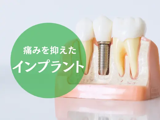 インプラント