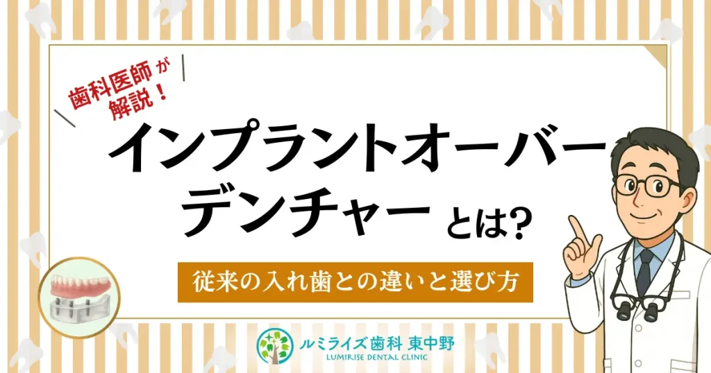 インプラントオーバーデンチャーとは？｜従来の入れ歯との違いと選び方