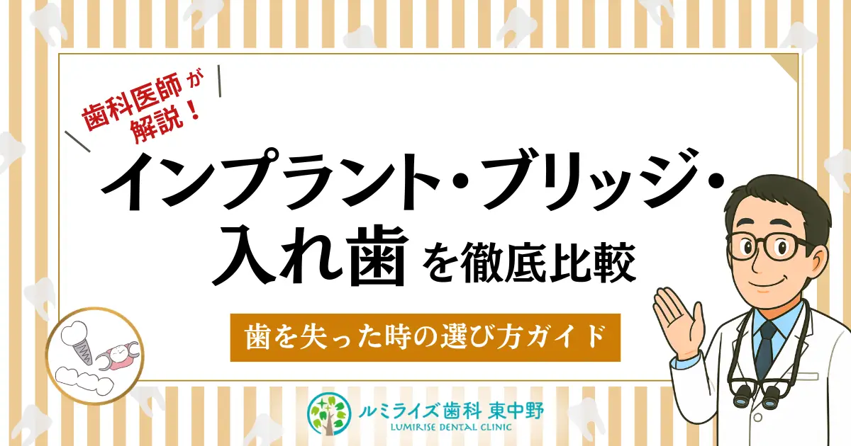 インプラント・ブリッジ・入れ歯を徹底比較！歯を失った時の選び方ガイド