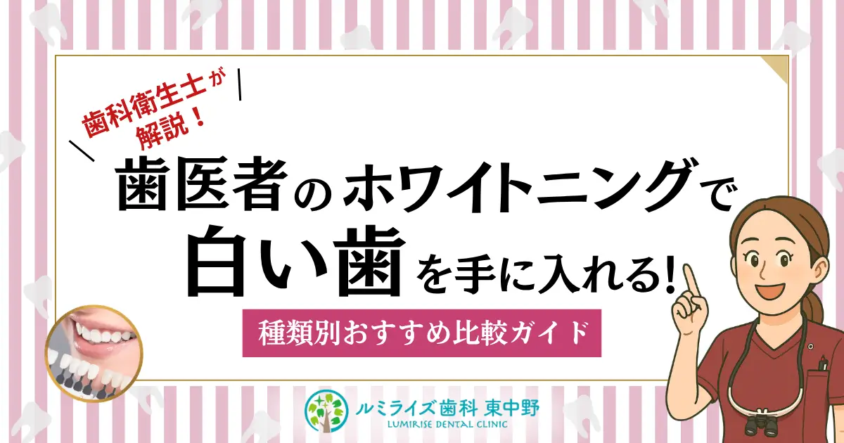 歯医者のホワイトニングで白い歯を手に入れる!種類別おすすめ比較ガイド