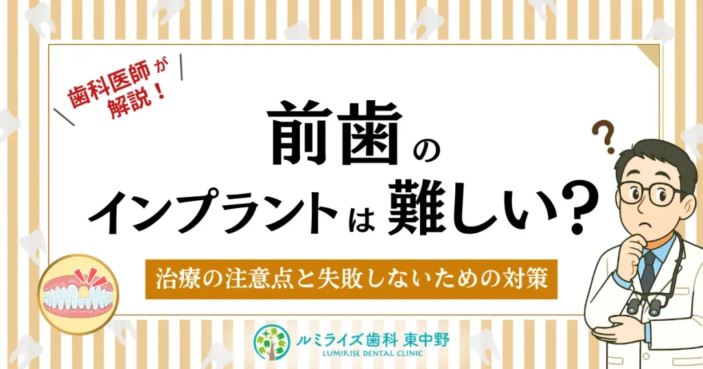 前歯のインプラントは難しい?治療の注意点と失敗しないための対策