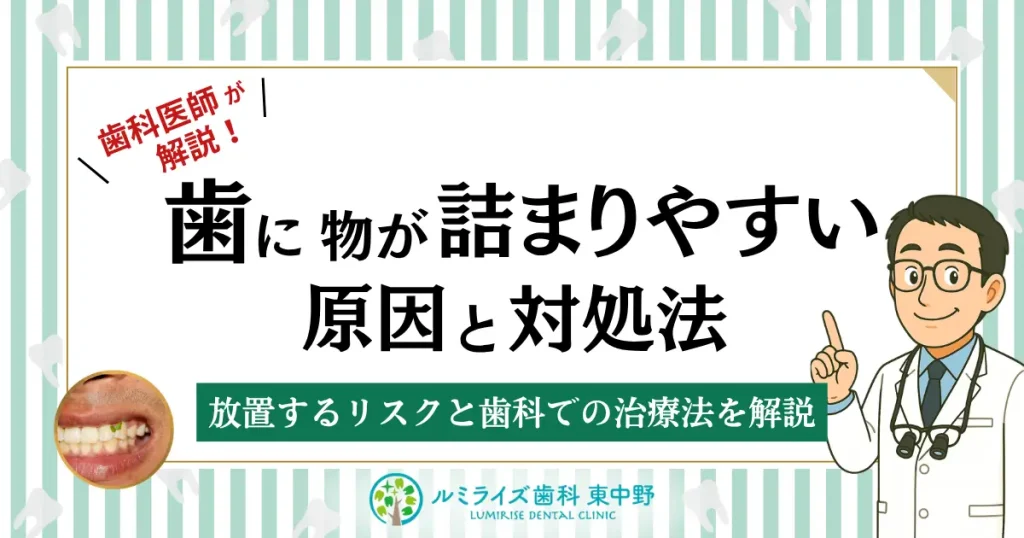 歯に物が詰まりやすい原因と対処法｜放置するリスクと歯科での治療法を解説