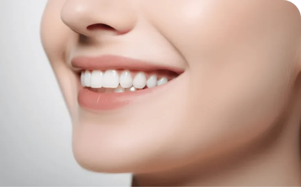 whitening 01
