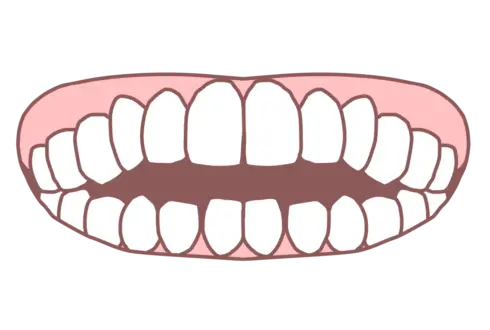 開咬