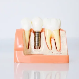 日曜診療インプラント・矯正相談（インビザライン）予約受付中_1